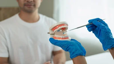 How Long Do Dental Implants Last with Proper Oral Care?