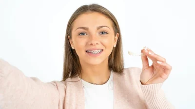 How Does Invisalign Work Compared to Traditional Braces?