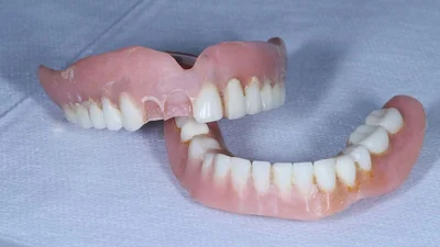 How to Repair a Broken Denture the Right Way